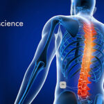 BIOTRONIK Neuro Acquires Spinal Cord Stimulation System from Soin Neuroscience