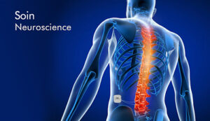 Read more about the article BIOTRONIK Neuro Acquires Spinal Cord Stimulation System from Soin Neuroscience