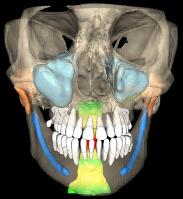 You are currently viewing VELMENI Receives FDA 510(k) Clearance for AI-Powered 3D CBCT Dental Imaging Software